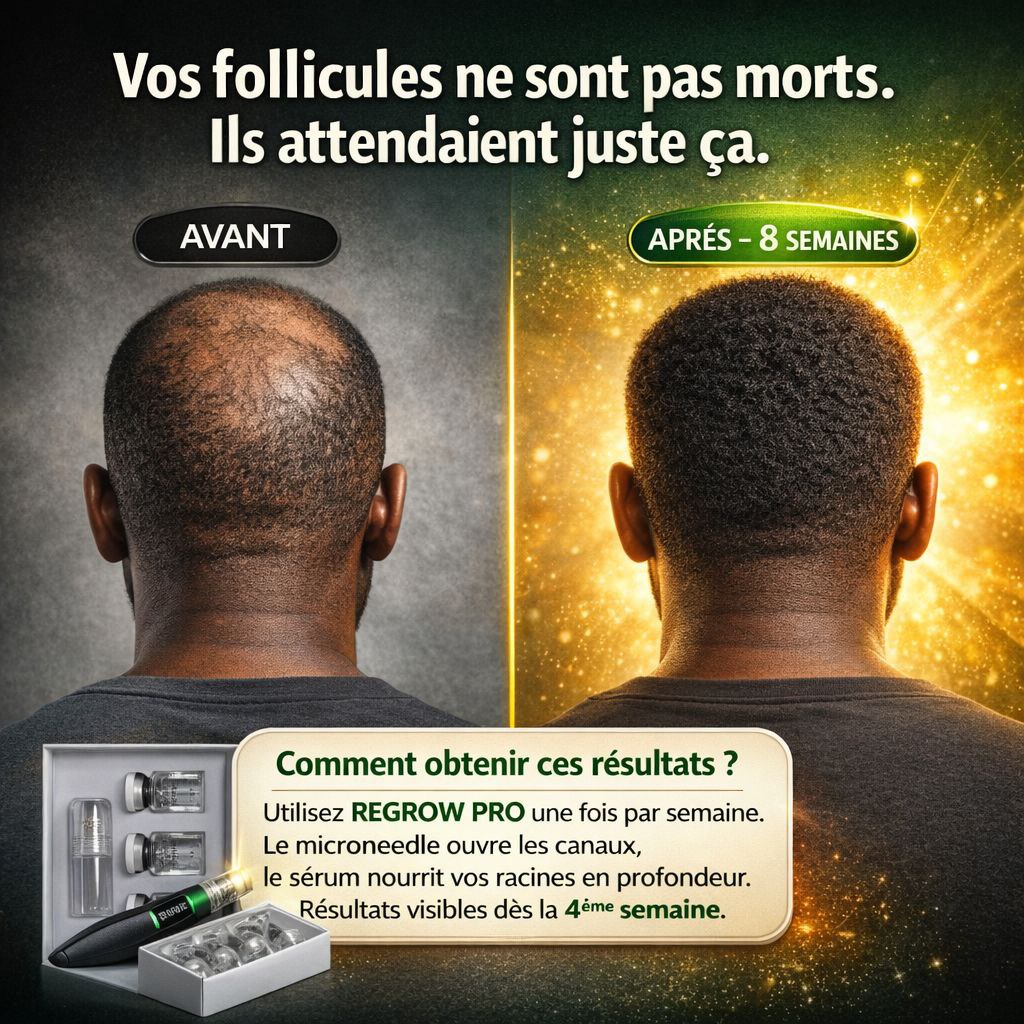 REPOUSSE PRO. Vos cheveux retrouvés en quelques semaines seulement.