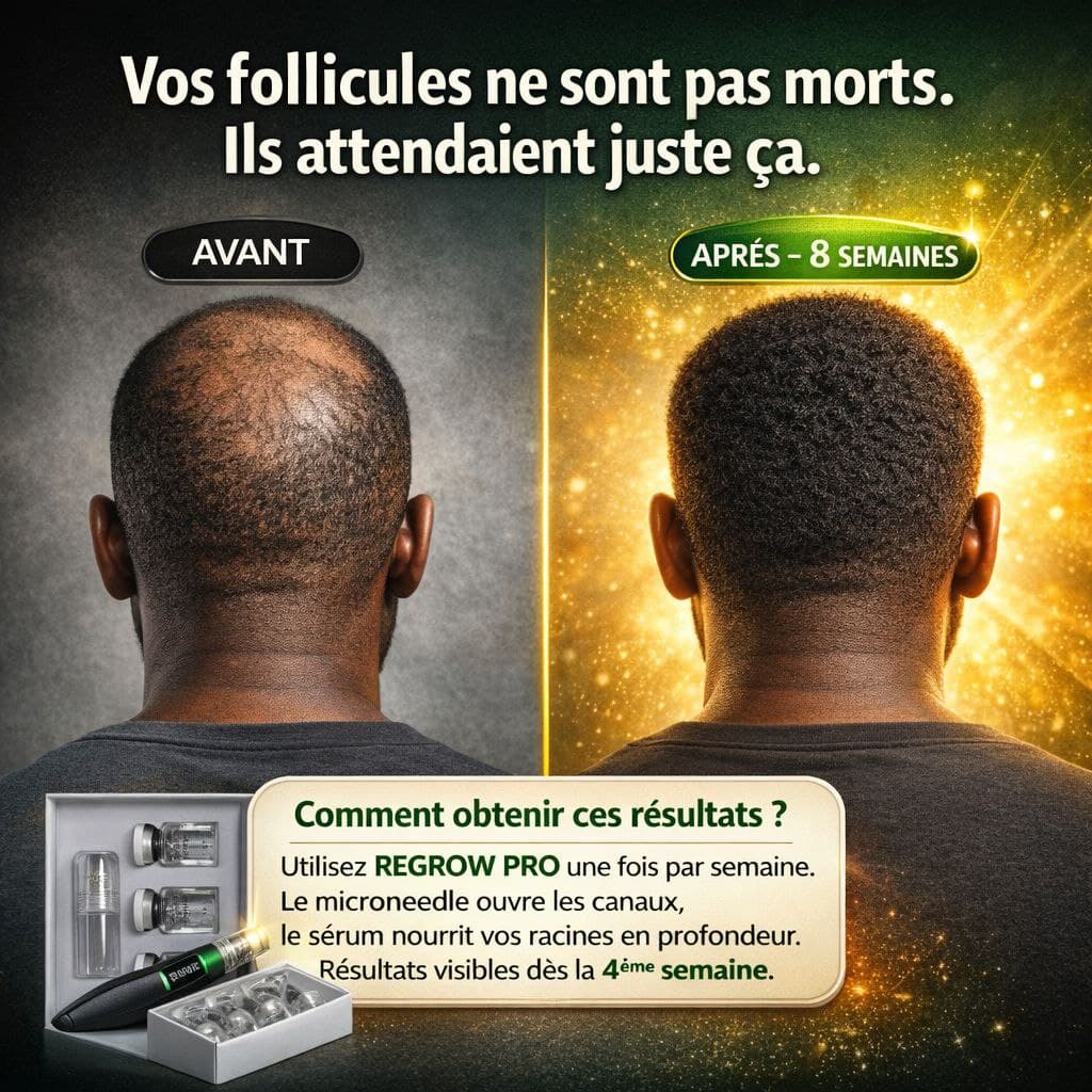 Vos cheveux retrouvés en quelques semaines seulement.